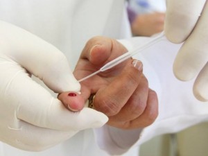 Peruíbe realizará testes rápidos para HIV, sífilis e hepatites virais